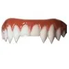 Dental FX Veneers Vampir Zähne